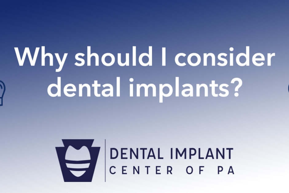 dental implants Why Should I Consider Dental Implants?