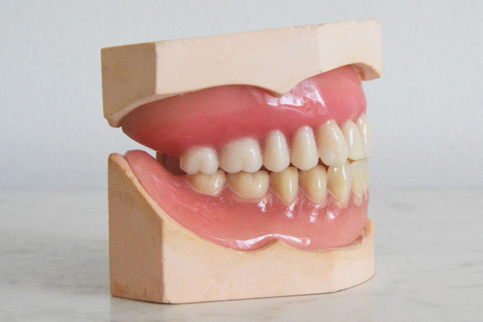dentures alternatives to dental implants