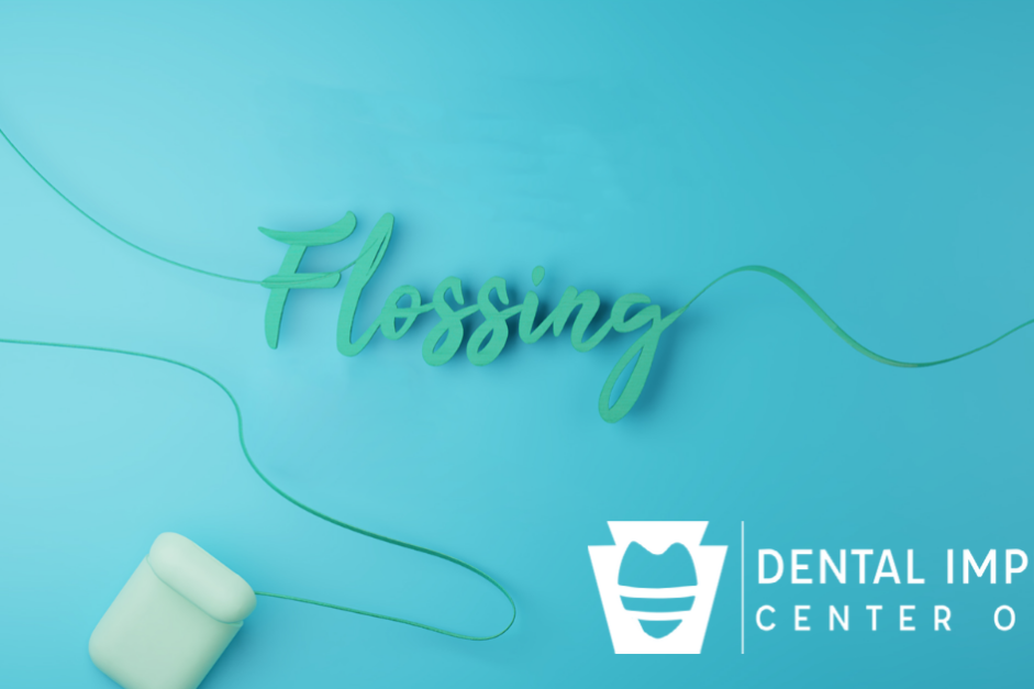 flossing Flossing implants