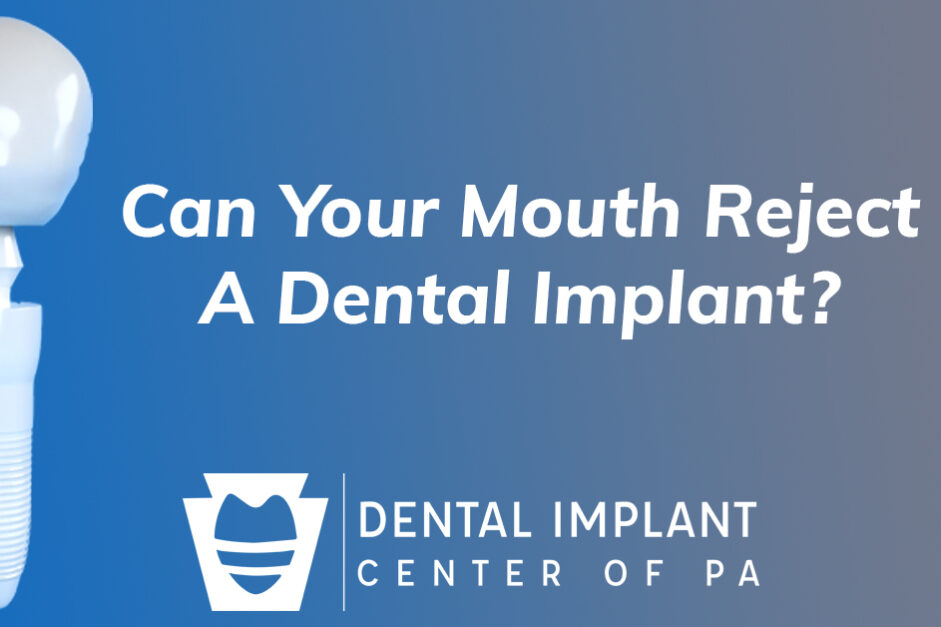 implant rejection implant rejection