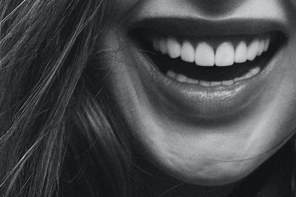 are dental implants safe? Woman with mouth open, how safe are dental implants