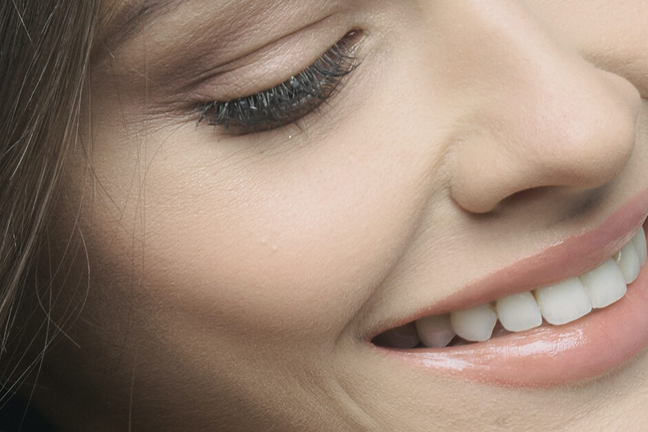 Dentures into Implants? Woman Smiling, can you turn dentures into implants