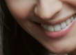 Woman Smiling, crowns vs natural teeth