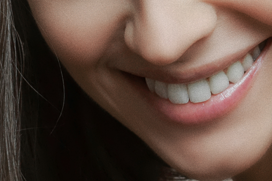 natural crowns_ Woman Smiling, crowns vs natural teeth