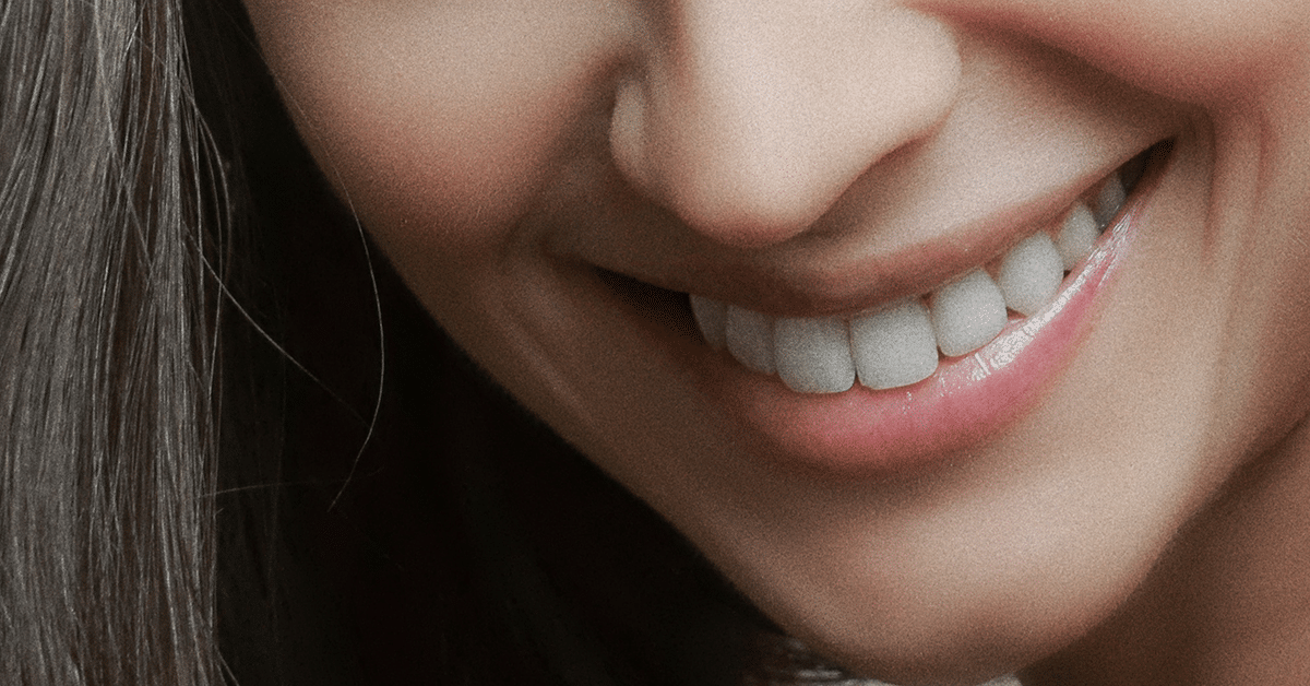 Woman Smiling, crowns vs natural teeth
