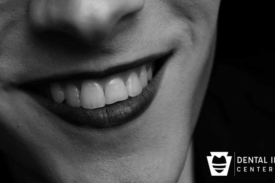 grey line Woman Smiling, gray line around crowns