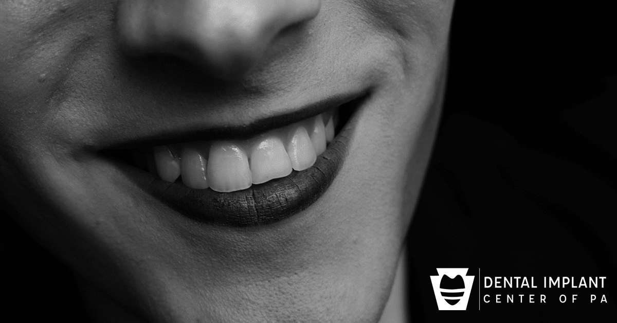 Woman Smiling, gray line around crowns