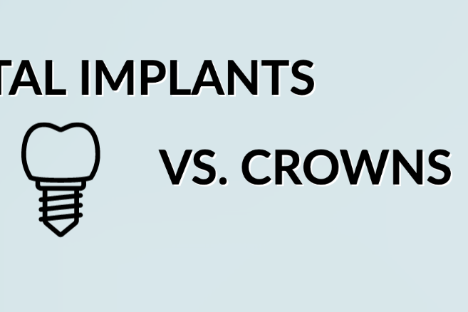 implants vs crowns implants vs crowns